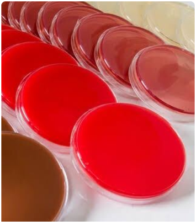 Agar Plates