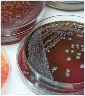 Bacteria Culture
