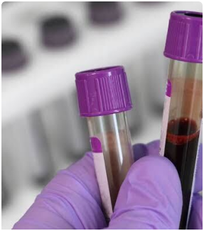 Haematolgy Assays